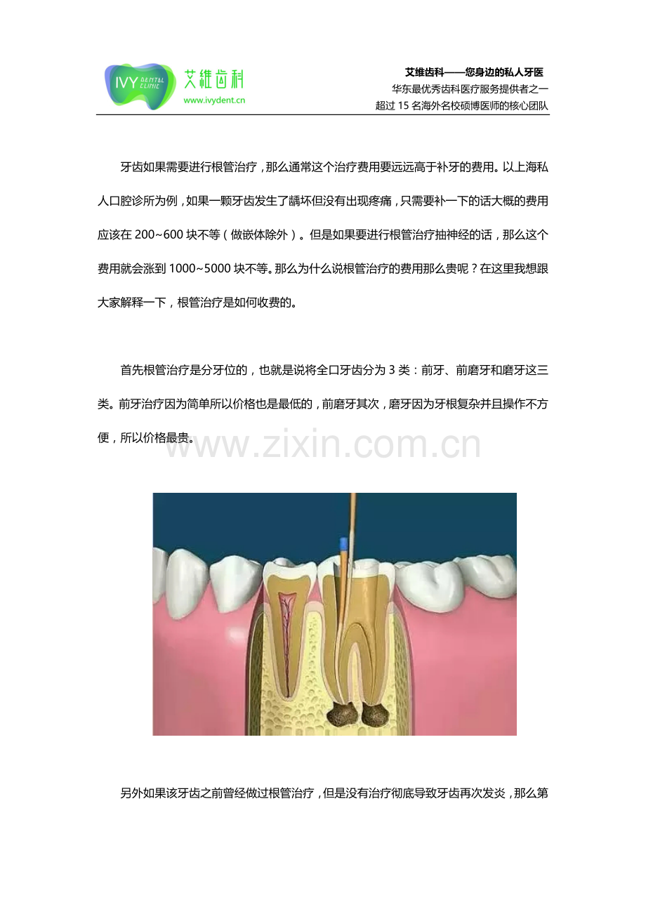 杭州口腔医院：牙齿根管治疗为什么会那么贵？.doc_第2页