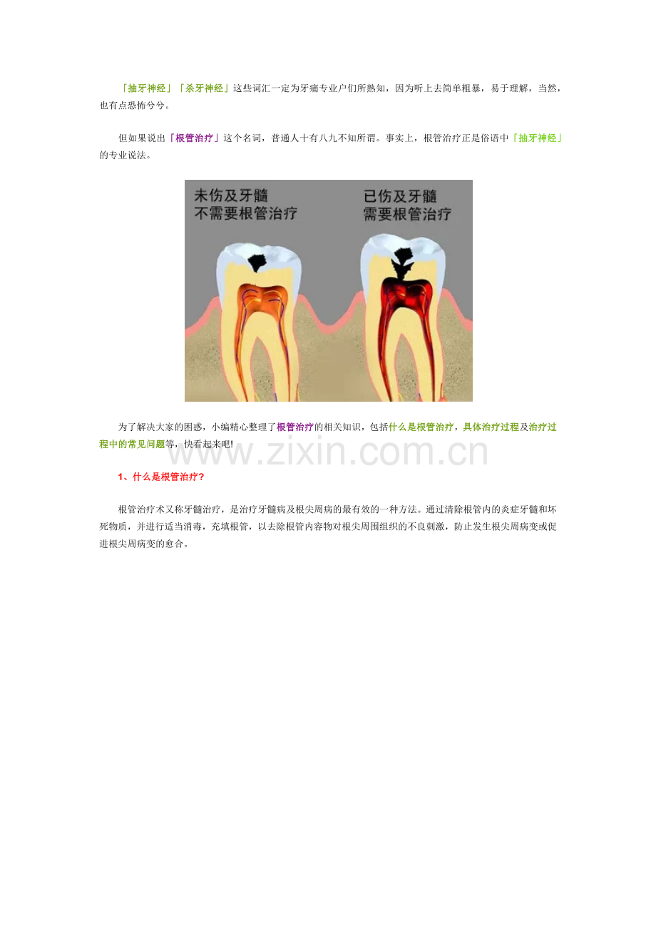 根管治疗是不是就是我们常说的抽牙神经？.docx_第1页
