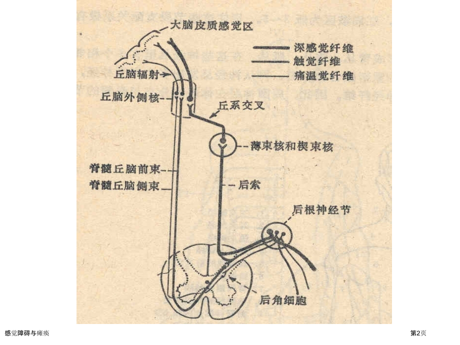 感觉障碍与瘫痪.pptx_第2页