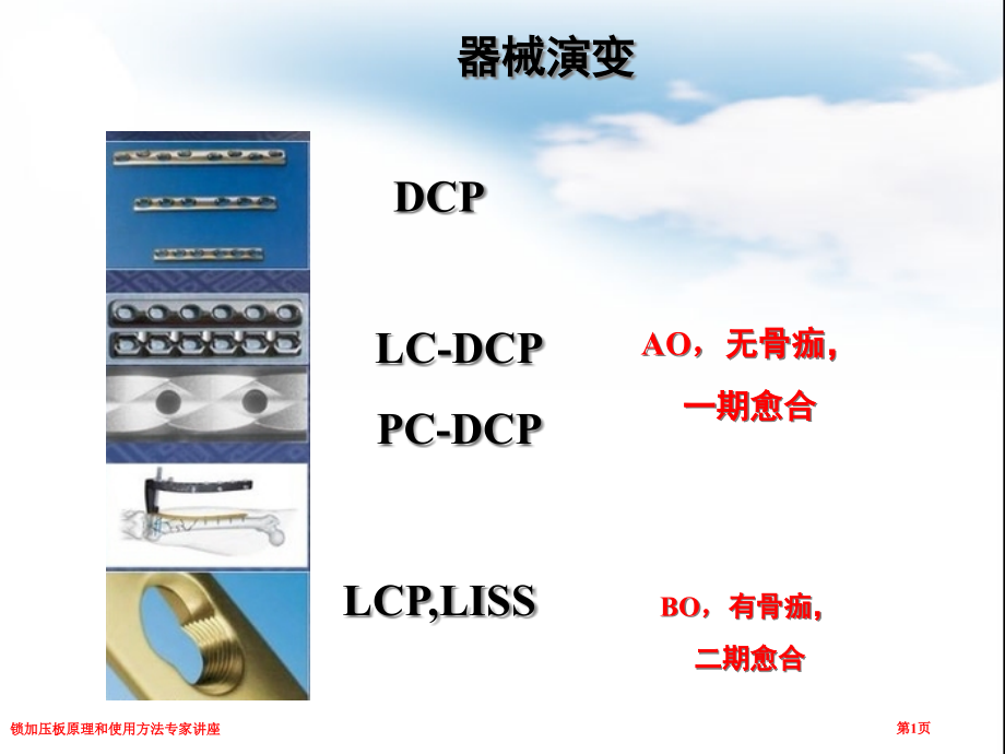 锁加压板原理和使用方法专家讲座.pptx_第1页