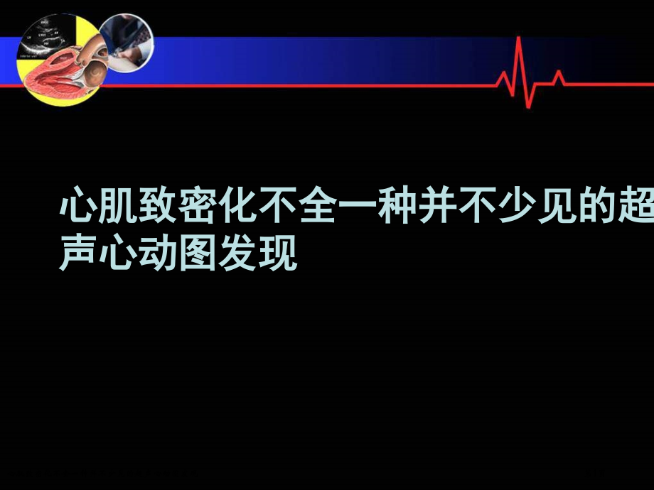 心肌致密化不全一种并不少见的超声心动图发现.pptx_第1页