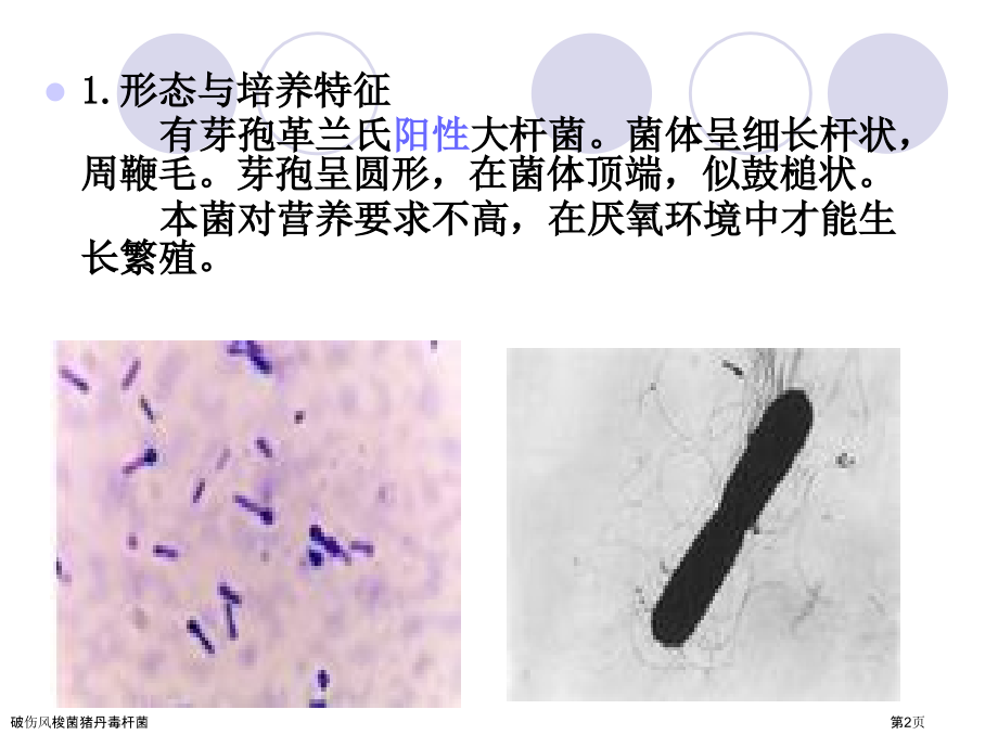破伤风梭菌猪丹毒杆菌.pptx_第2页