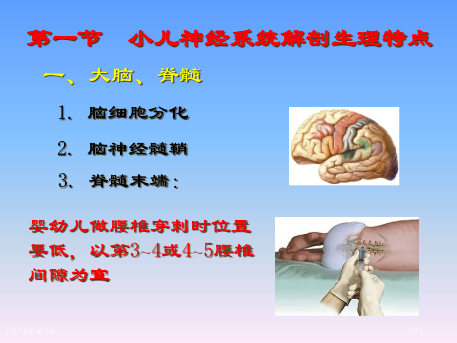 小儿化脓性脑膜炎.pptx_第2页