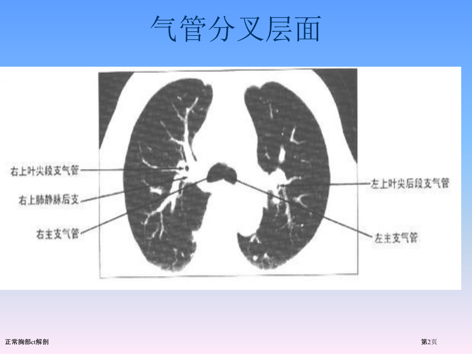 正常胸部ct解剖.pptx_第2页