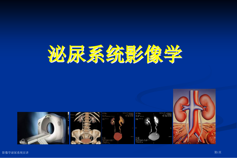 影像学泌尿系统宣讲.pptx_第1页