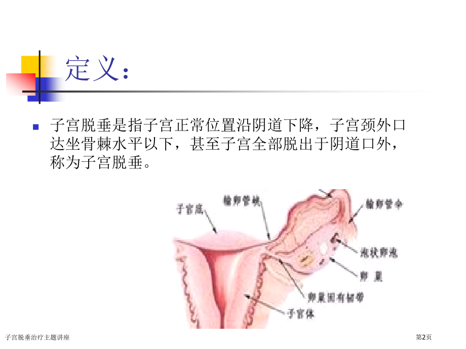 子宫脱垂治疗主题讲座.pptx_第2页