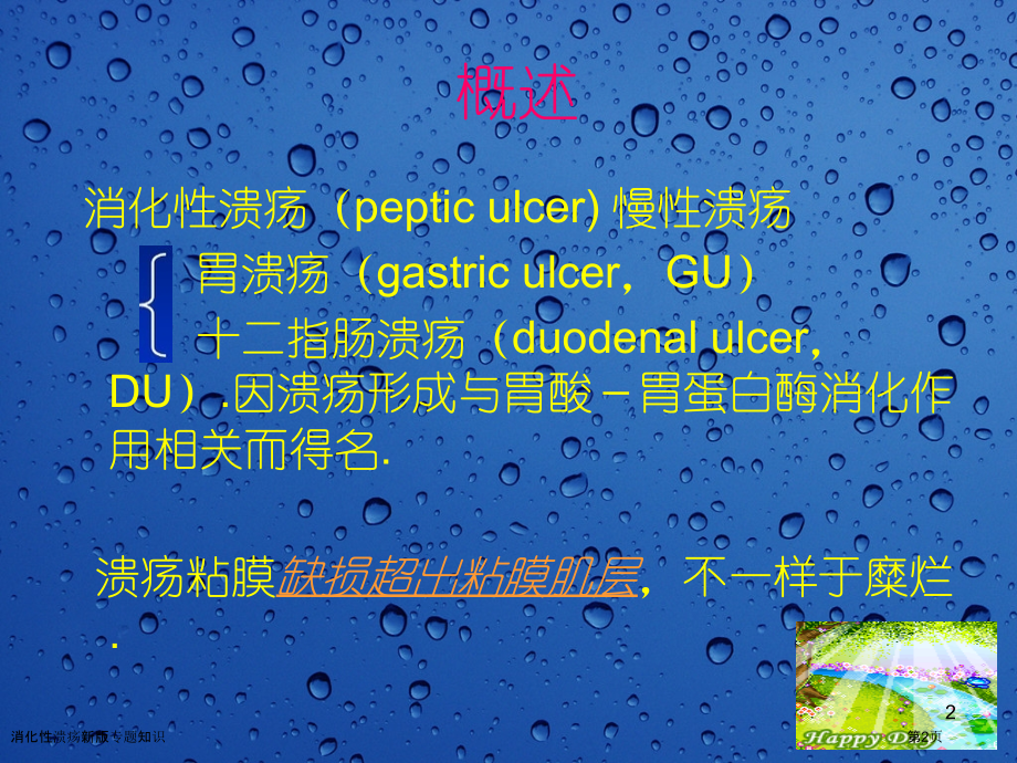 消化性溃疡新版专题知识.pptx_第2页