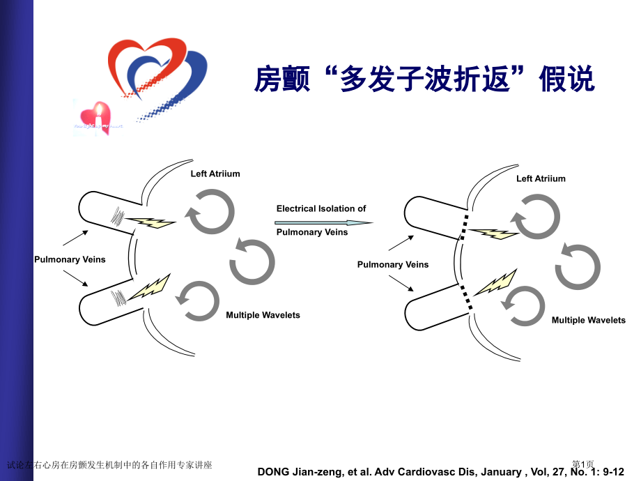 试论左右心房在房颤发生机制中的各自作用专家讲座.pptx_第1页