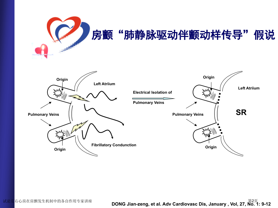 试论左右心房在房颤发生机制中的各自作用专家讲座.pptx_第2页