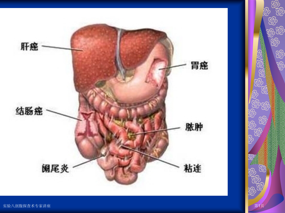实验八剖腹探查术专家讲座.pptx_第1页