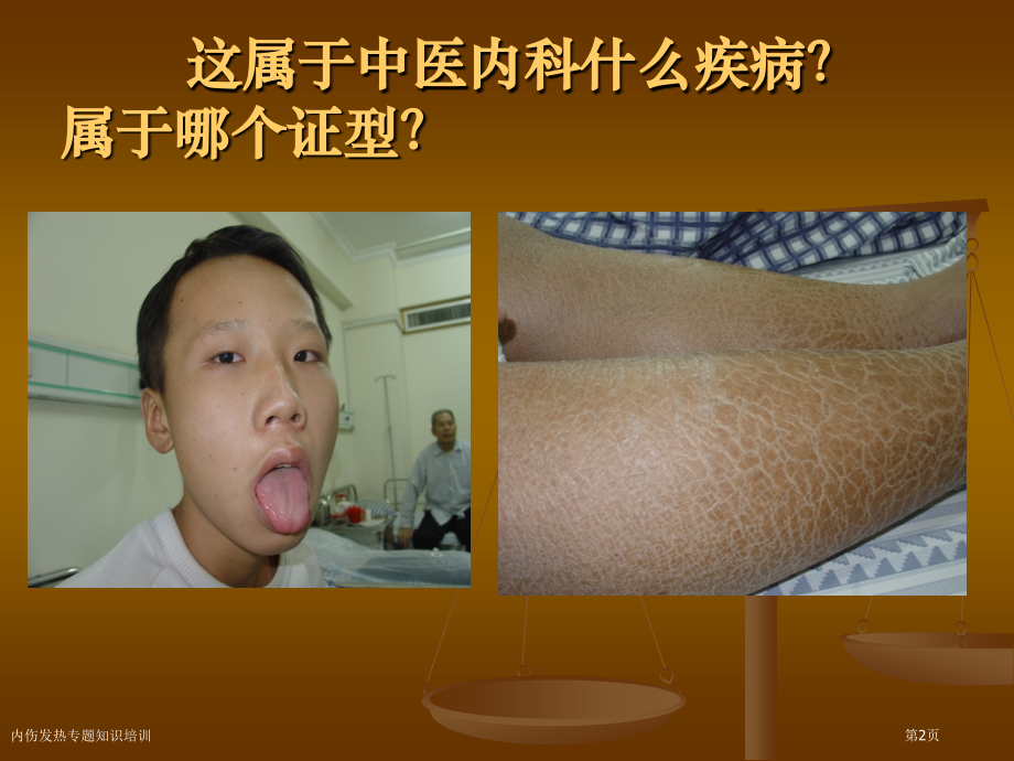 内伤发热专题知识培训.pptx_第2页
