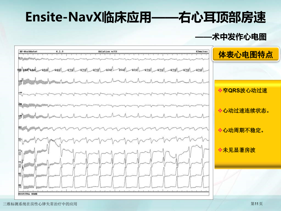 三维标测系统在房性心律失常治疗中的应用.pptx_第2页