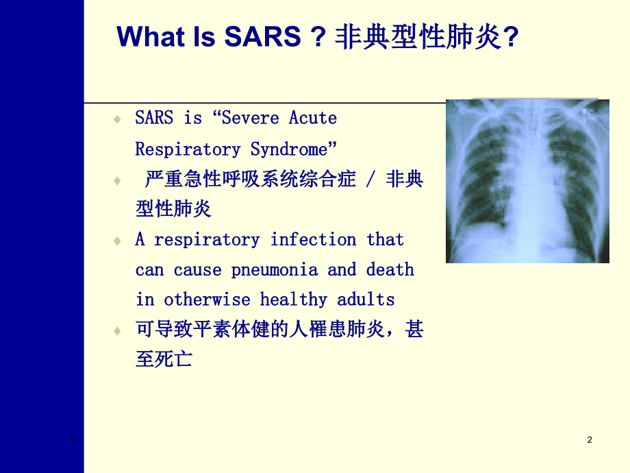 非典知识讲座.ppt_第2页