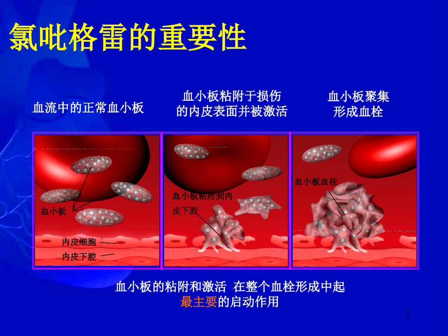 氯吡格雷抵抗.ppt_第2页