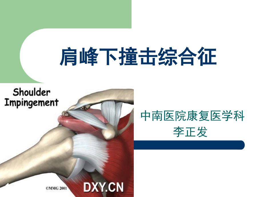 肩峰下撞击综合征再次修改.ppt_第1页