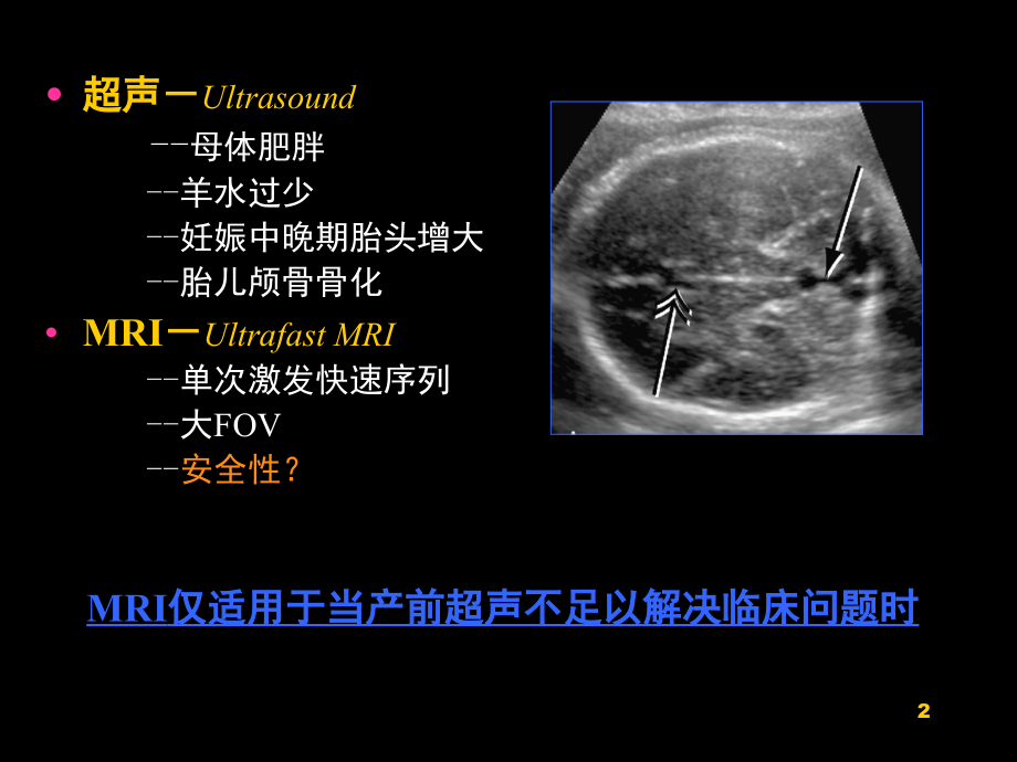 胎儿磁共振成像胎儿头颅MRI检查(课堂PPT).ppt_第2页