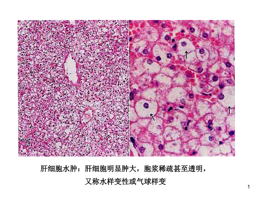 病理图片描述(课堂PPT).ppt_第1页