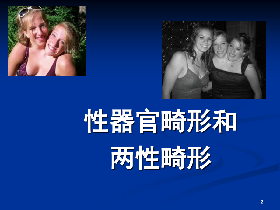 性器官畸形和两性畸形(课堂PPT).ppt_第2页