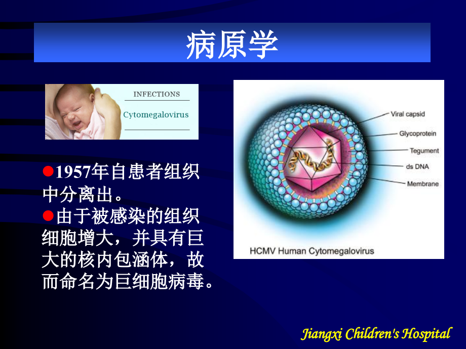 巨细胞病毒.ppt_第2页