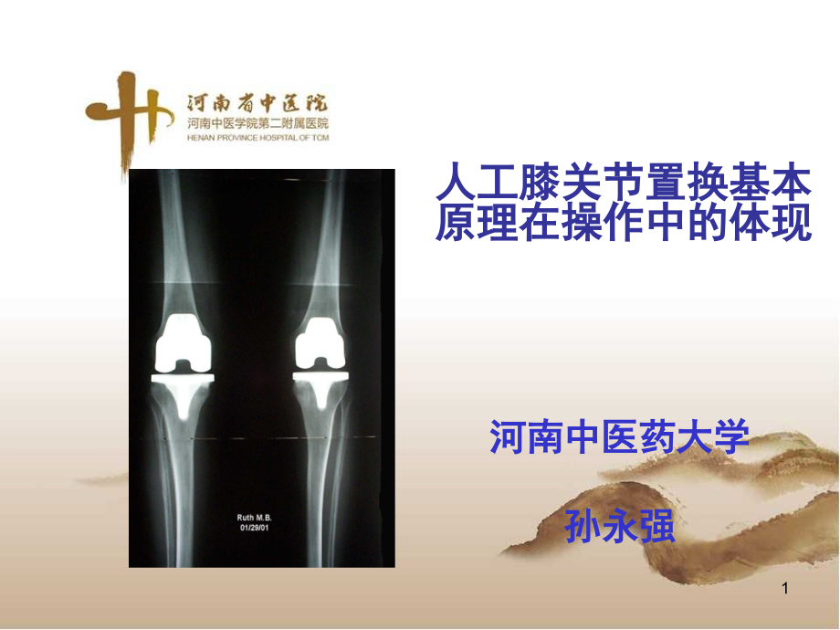 人工膝关节置换基本原理在操作中的体现PPT课件.ppt_第1页