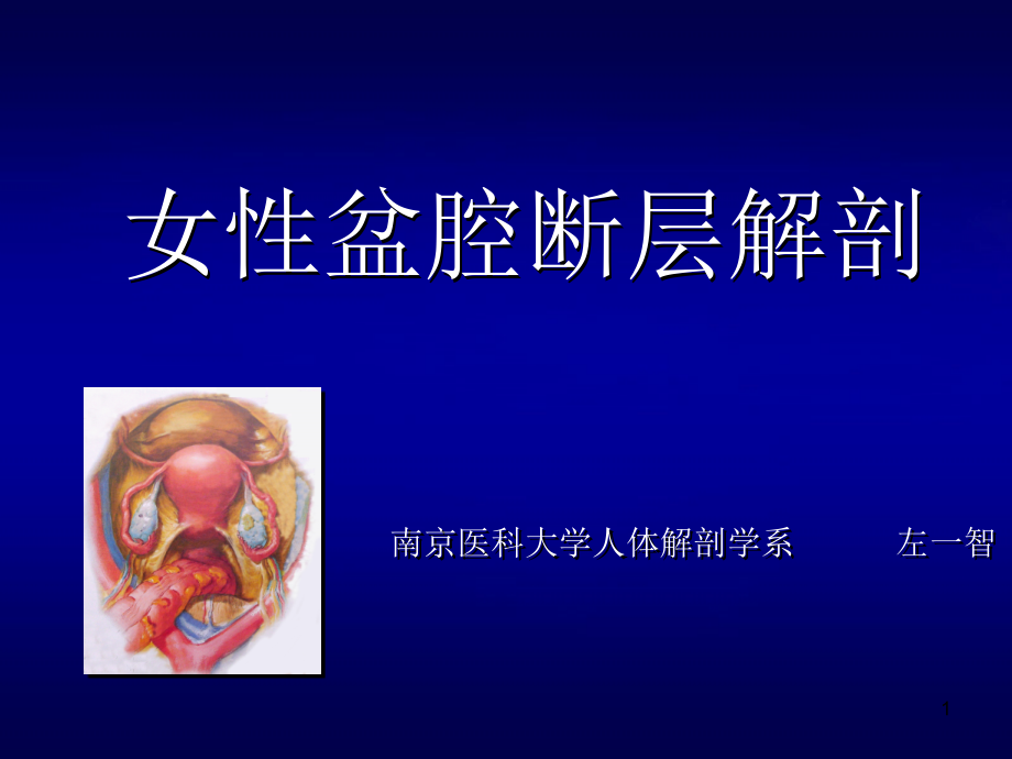 女性盆腔断层解剖.ppt_第1页