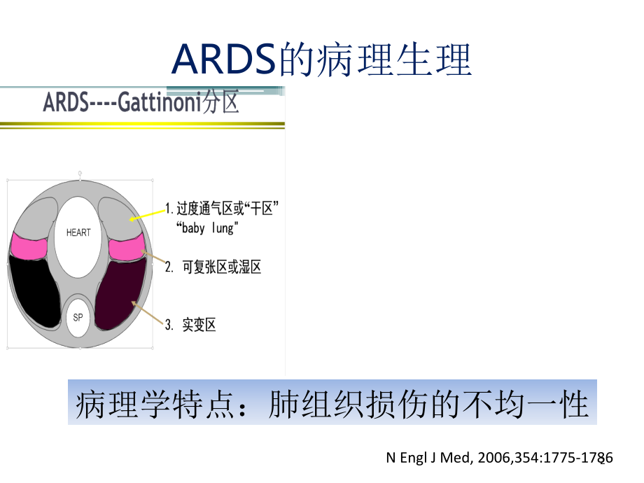 ARDS肺可复张性评估课件.ppt_第2页