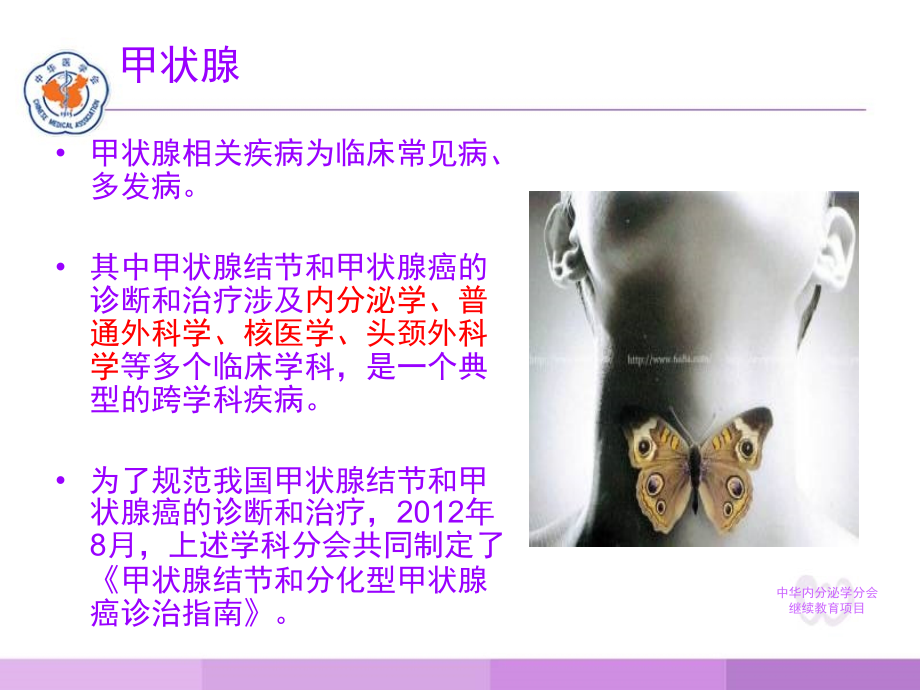 甲状腺结节医学PPT课件.ppt_第2页