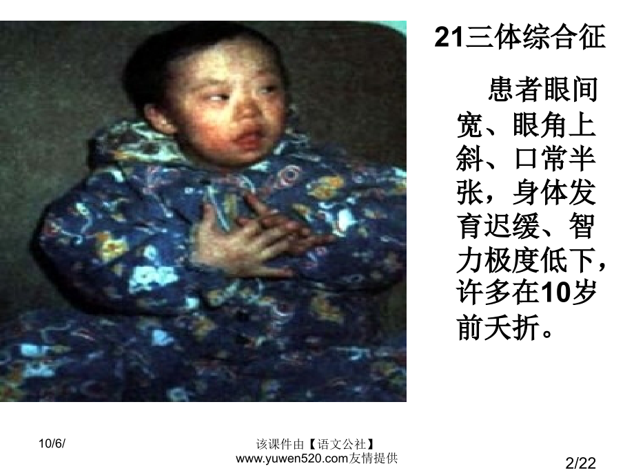 染色体变异人教版市公开课获奖课件省名师优质课赛课一等奖课件.ppt_第2页