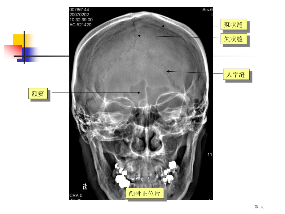 中枢神经系统医学影像学本科五年制第五版市公开课一等奖省优质课赛课一等奖课件.pptx_第1页