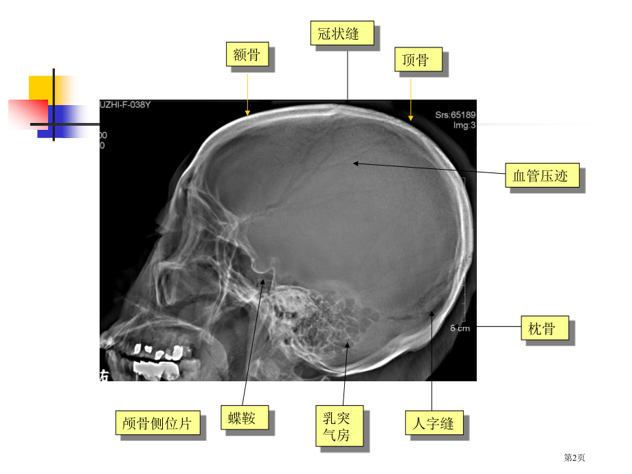 中枢神经系统医学影像学本科五年制第五版市公开课一等奖省优质课赛课一等奖课件.pptx_第2页