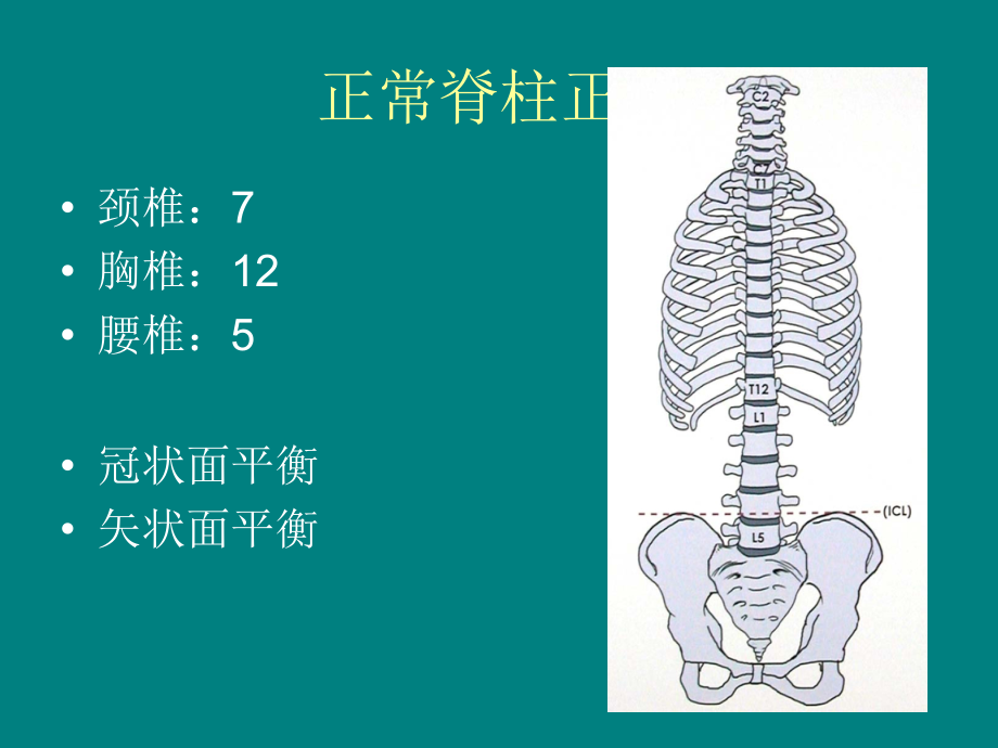 脊柱侧弯.ppt_第2页