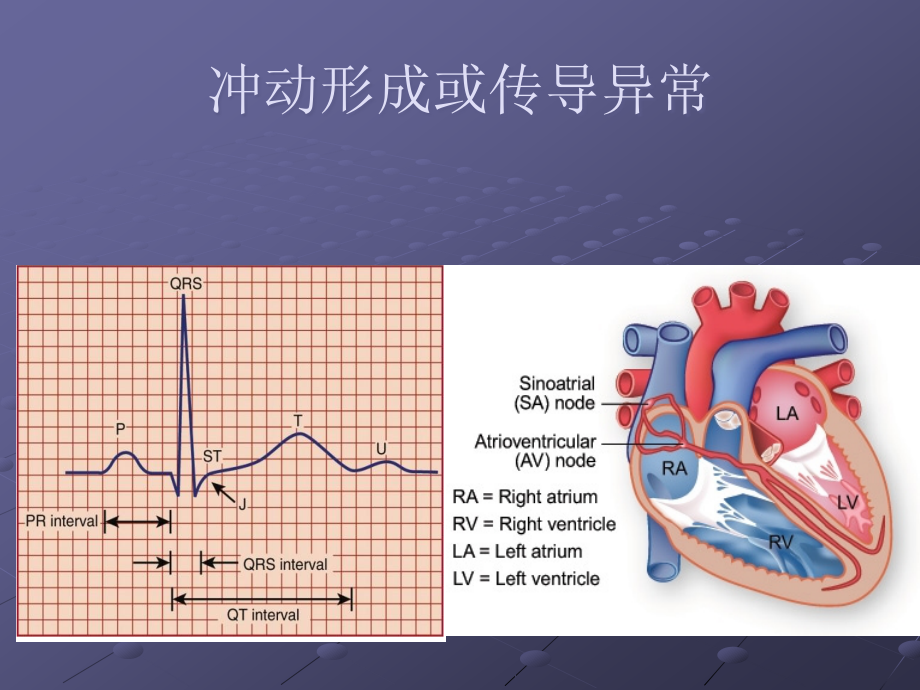 手术麻醉期心律失常.ppt_第2页