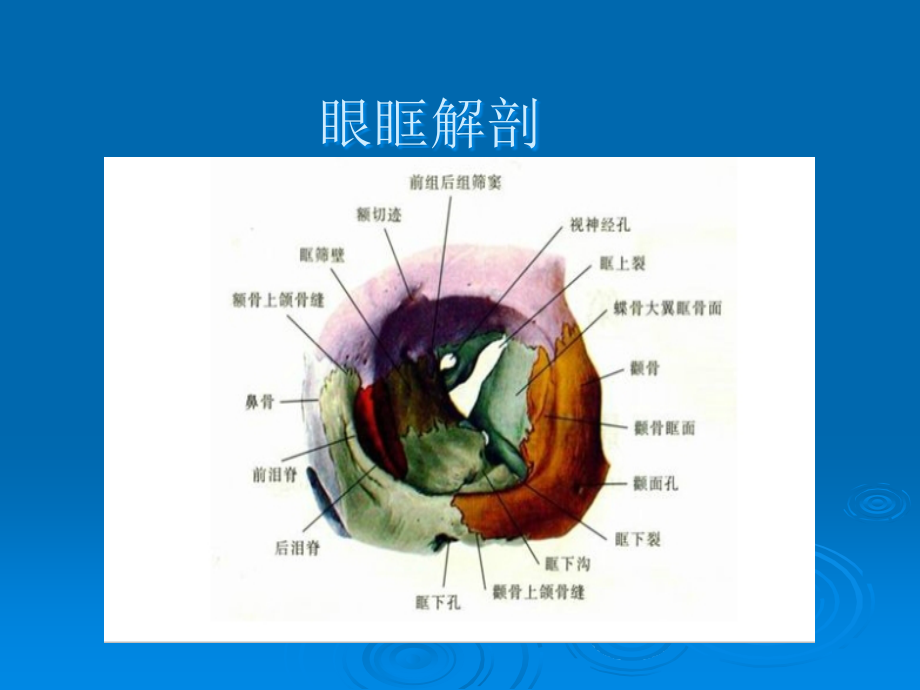 视神经鞘脑膜瘤.ppt_第2页