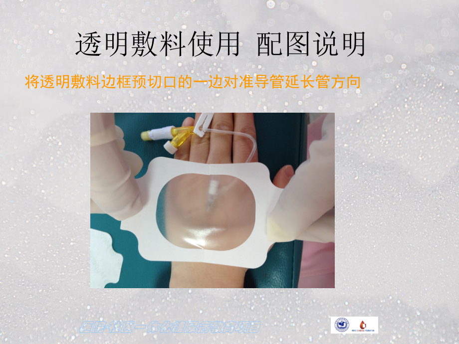 留置针固定及护理.ppt_第2页