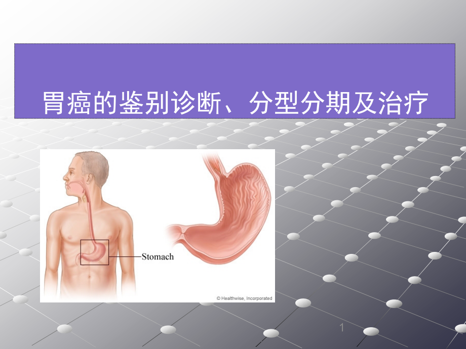 胃癌的鉴别诊断及分型治疗.ppt_第1页