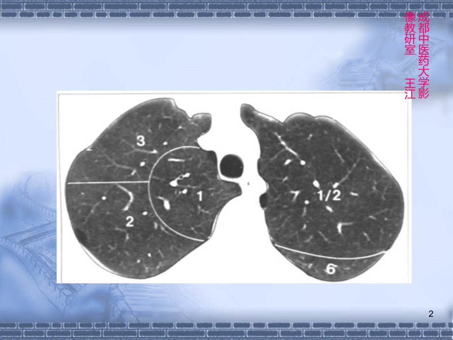 胸部CT肺窗：肺叶、肺段PPT课件.ppt_第2页