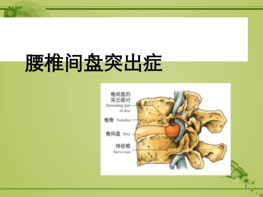 腰椎间盘突出症病人的护理-ppt课件.ppt_第1页