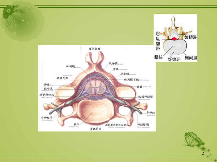 腰椎间盘突出症病人的护理-ppt课件.ppt_第2页