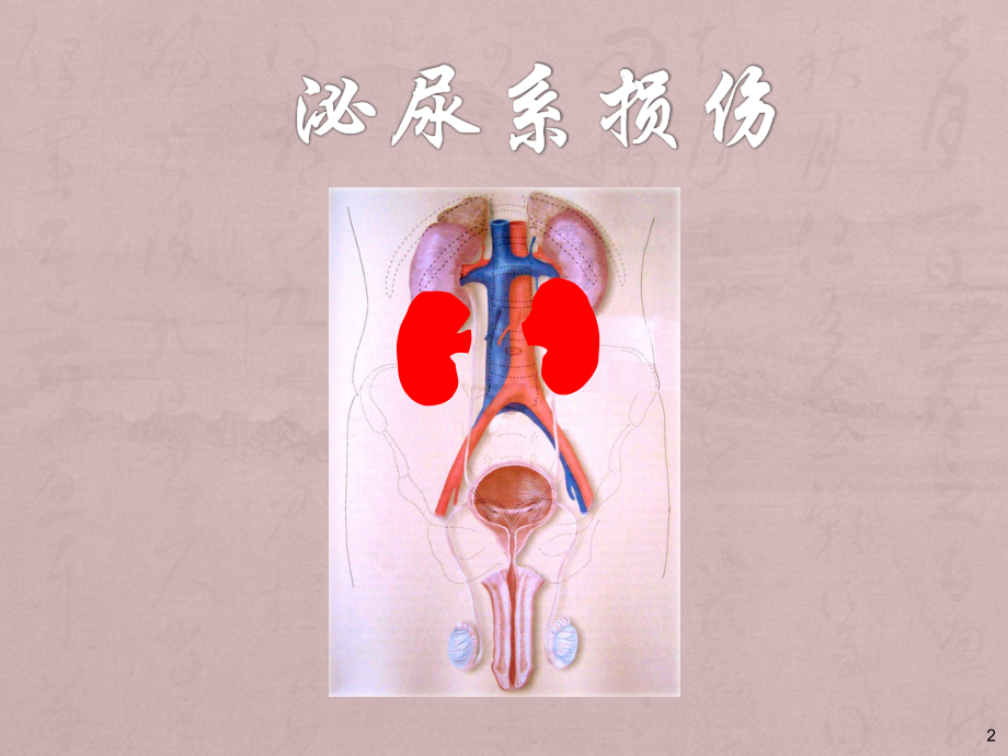 血尿病人的护理措施-ppt课件.ppt_第2页