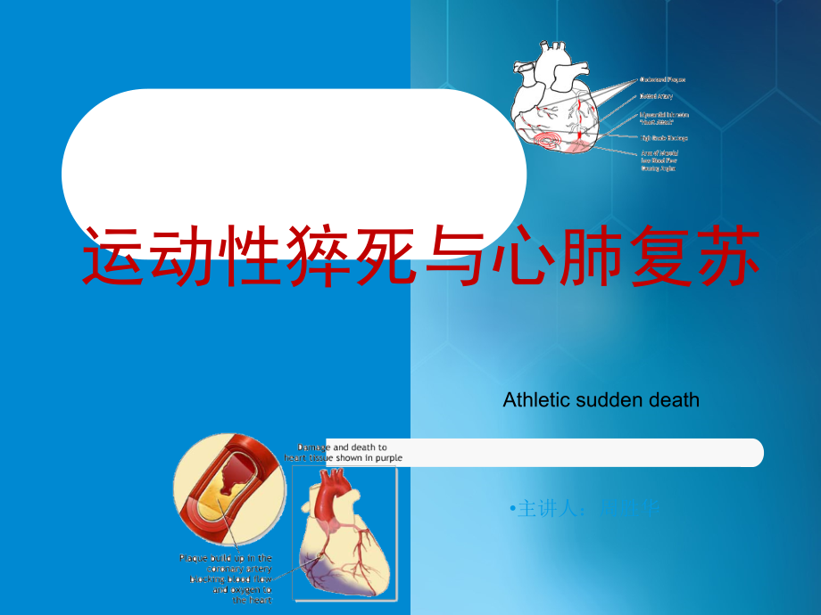 运动性猝死ppt课件.ppt_第1页