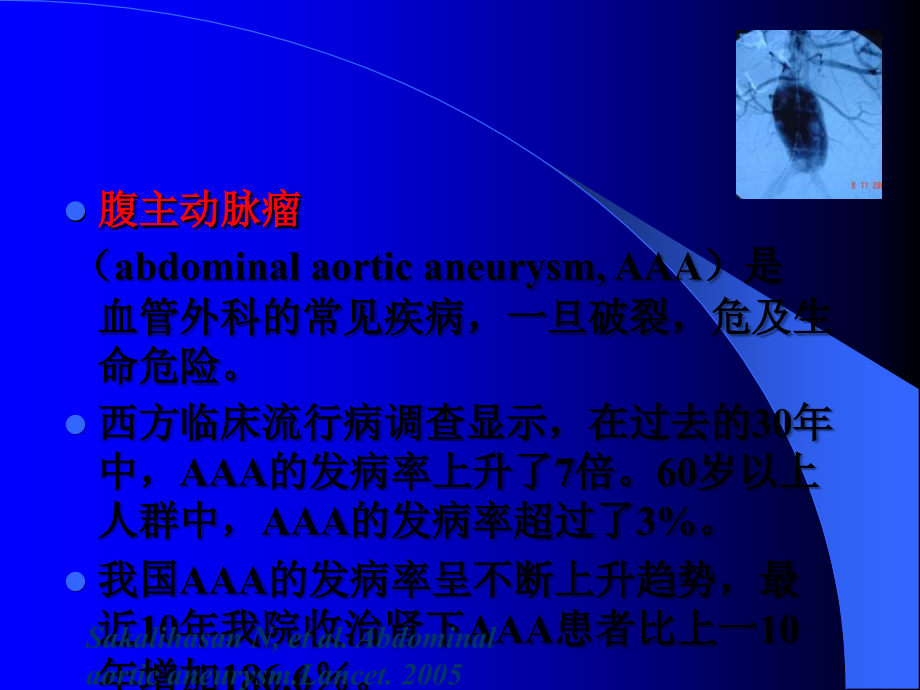 腹主动脉瘤的诊断与治疗ppt课件.ppt_第2页