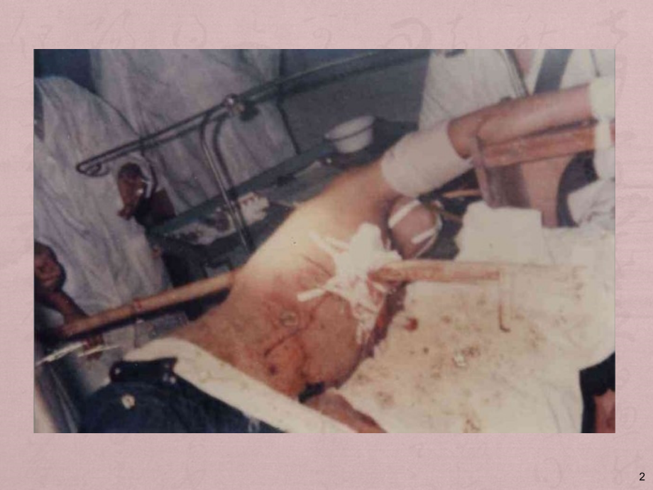 胸外伤诊治及新进展-ppt课件.ppt_第2页