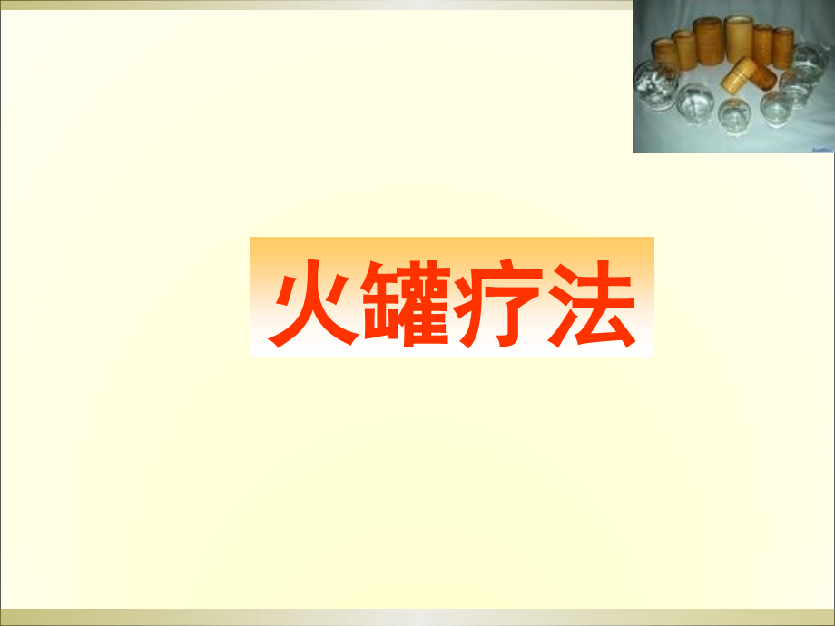 火罐疗法ppt课件.ppt_第1页