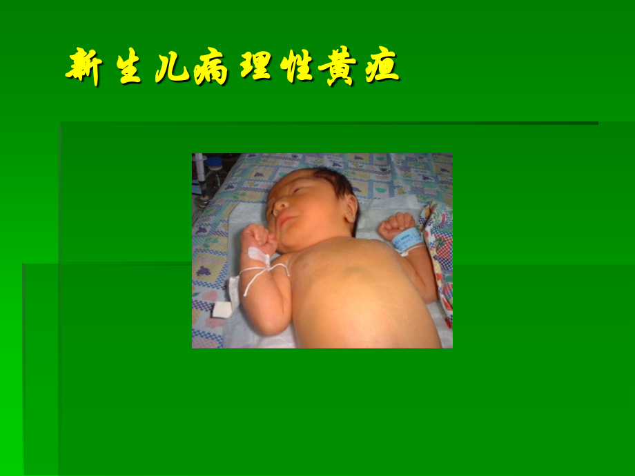 新生儿病理性黄疸ppt课件.ppt_第1页