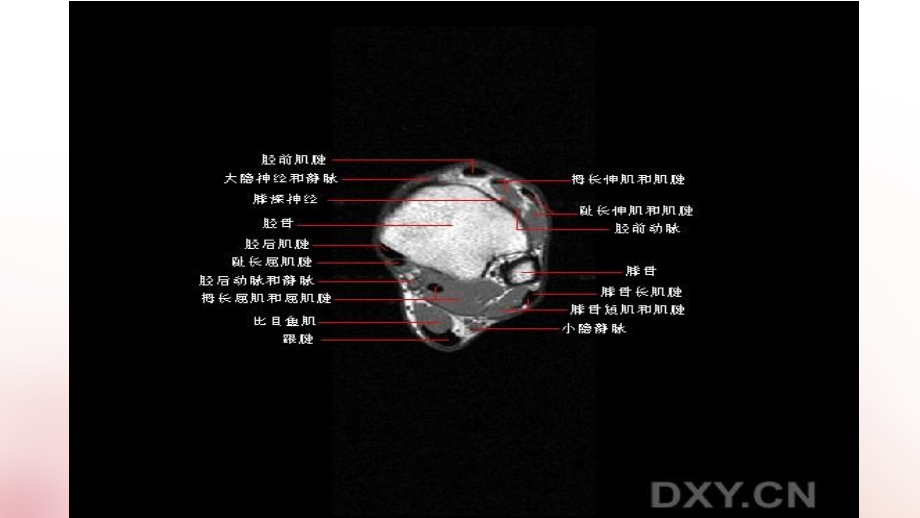 正常踝关节MR解剖ppt课件.ppt_第2页