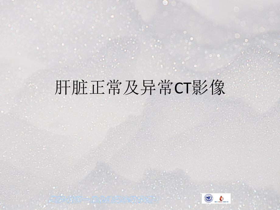 肝脏正常及异常CT影像ppt课件.pptx_第1页