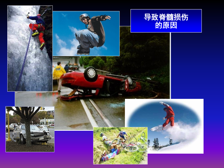 高位截瘫ppt课件(1).ppt_第2页