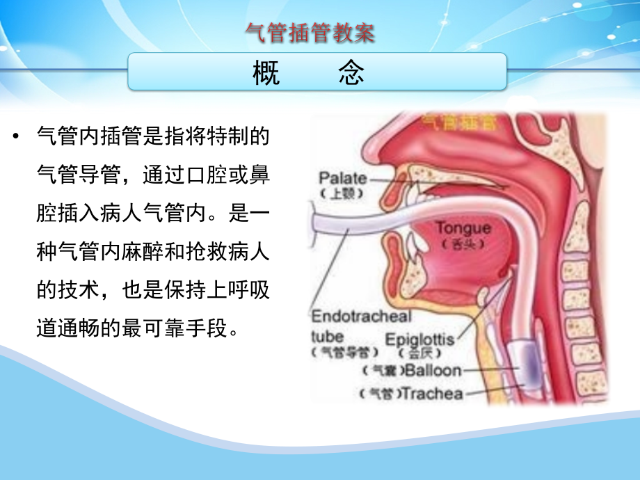 气管插管教案.pptx_第1页