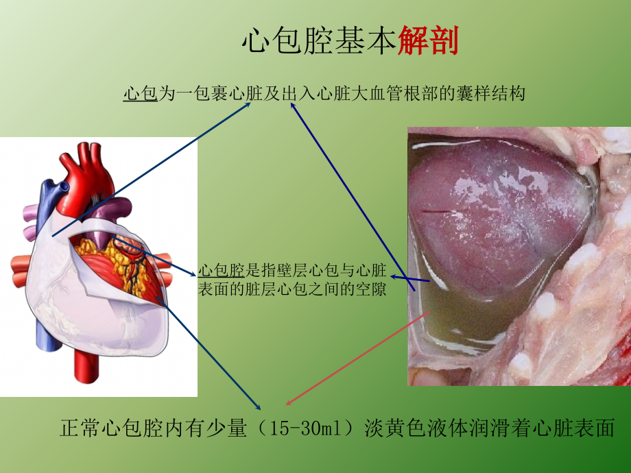 心包填塞正式版ppt课件.ppt_第2页