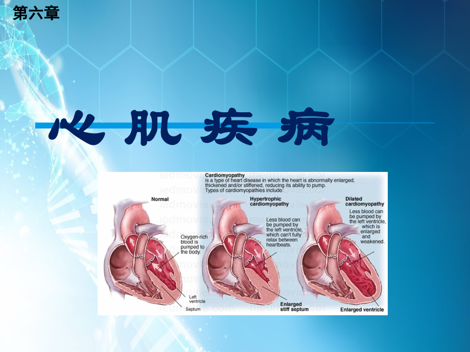 心肌疾病ppt课件.pptx_第1页